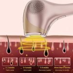 IPL Hair Removal Device with Cooling Function 600,000 Flashes - Image 4